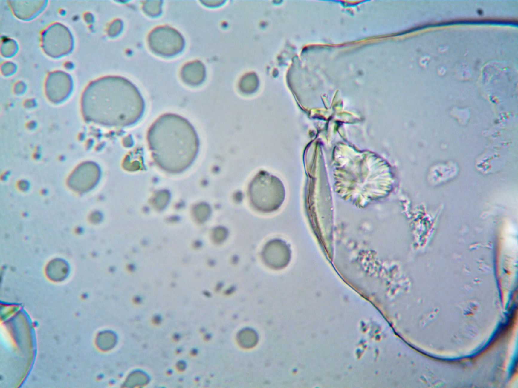 Calcestruzzo che respira: la rivoluzione del bioconcrete con batteri vivi che ripara da solo le crepe e cattura CO₂